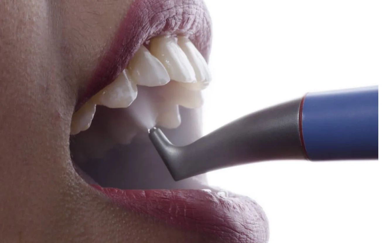 Dental Hygienist Croydon General Dentistry New Private Patients Appointments Available at Smile 4 U Dental Practice